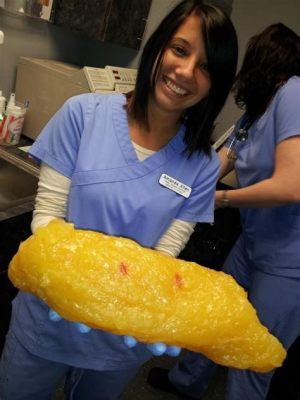 What Does One Pound of Fat Look Like? And Why Does It Remind Me of a Melted Candle?